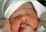 Looking after children's delicate skin
